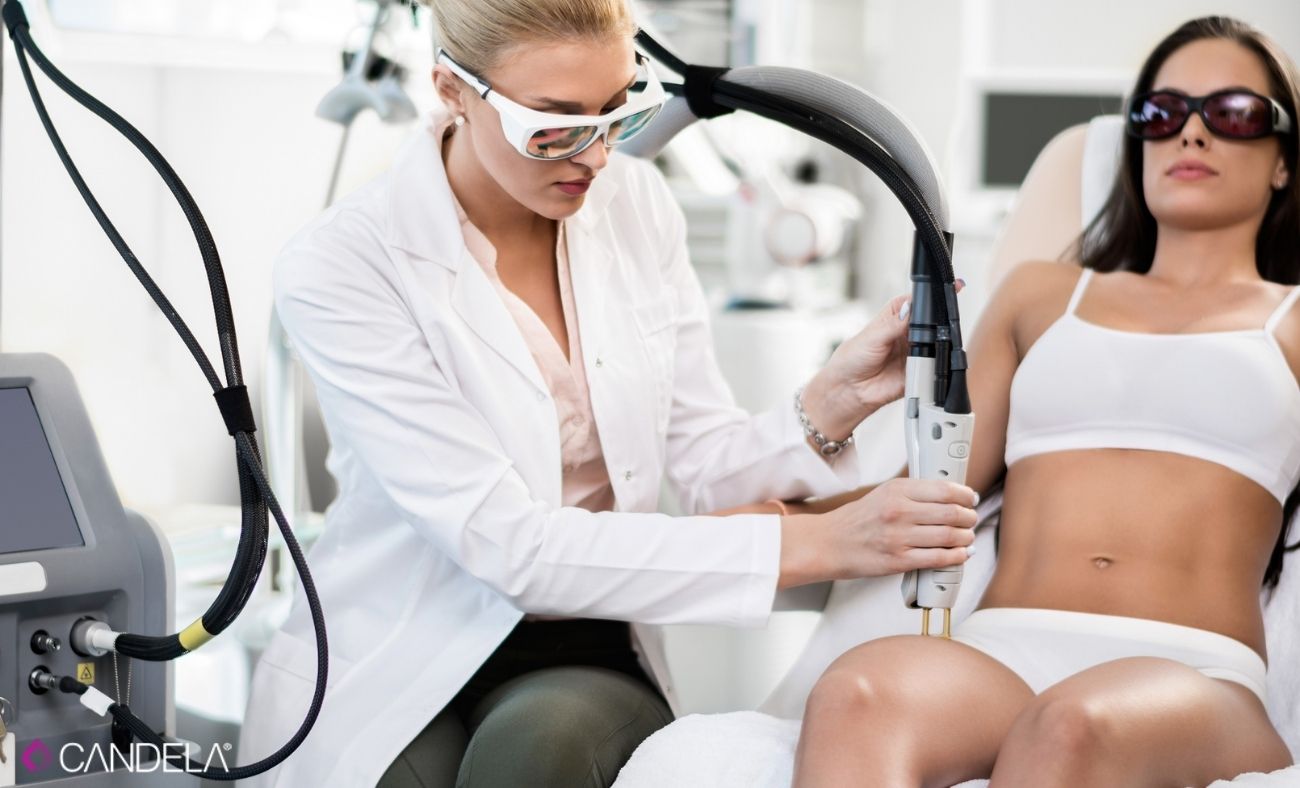 candela laser hair removal device laser hair removal at Tonicity Health